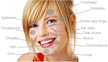 Result-Facial-lipofilling